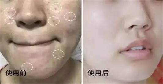 氨基酸洗面奶只认芙丽芳丝那你就out了,永芳这款性价比更高 2020 氨基酸 洗面 第13张 氨基酸洗面奶只认芙丽芳丝那你就out了,永芳这款性价比更高 2020 氨基酸 洗面 第13张