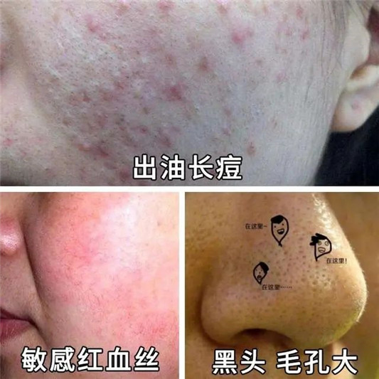 日本魔女石田百合子「50岁长着18岁的脸 看来这件事没白做」  2020 皮肤 洗面奶 第6张