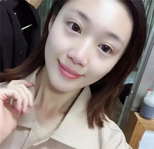 如何一眼辨别整容脸「灯光下变透明 打了玻尿酸也能一清二楚  2020 女生 双眼皮 第8张