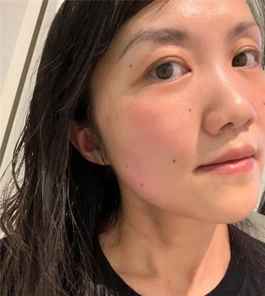 经常护肤和不护肤的女生「皮肤差别大吗不对比,真的看不出来」 2020 皮肤 护肤 第4张 经常护肤和不护肤的女生「皮肤差别大吗不对比,真的看不出来」 2020 皮肤 护肤 第4张