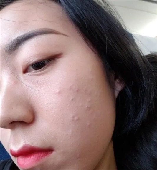 经常护肤和不护肤的女生「皮肤差别大吗不对比,真的看不出来」 2020 皮肤 护肤 第6张 经常护肤和不护肤的女生「皮肤差别大吗不对比,真的看不出来」 2020 皮肤 护肤 第6张