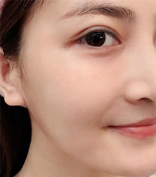 经常护肤和不护肤的女生「皮肤差别大吗不对比,真的看不出来」 2020 皮肤 护肤 第9张 经常护肤和不护肤的女生「皮肤差别大吗不对比,真的看不出来」 2020 皮肤 护肤 第9张