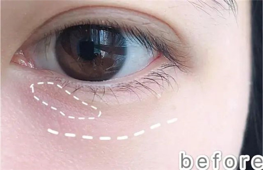 国货眼霜哪家强「新面孔大火 京卫本草零缺点 大宝眼霜保湿满分」