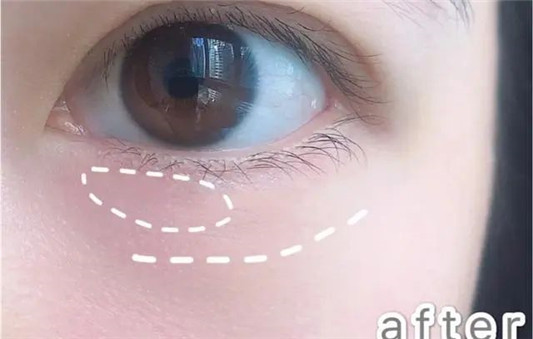 国货眼霜哪家强「新面孔大火 京卫本草零缺点 大宝眼霜保湿满分」 2020 眼霜 眼睛 第2张 国货眼霜哪家强「新面孔大火 京卫本草零缺点 大宝眼霜保湿满分」 2020 眼霜 眼睛 第2张