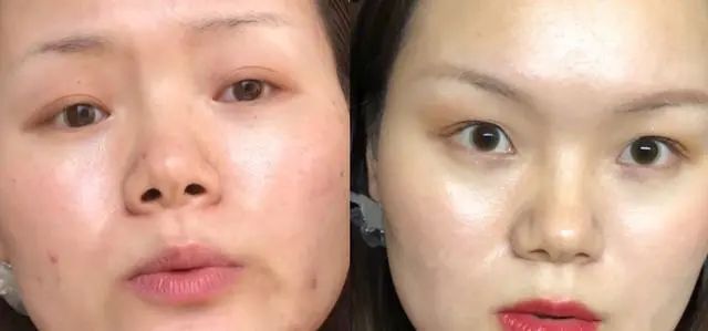 油皮夏天不好混「学会7个护肤技巧 清爽舒适轻松拥有」  油皮 护肤 第6张