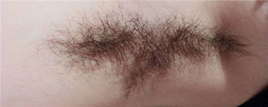 腋毛可以用脱毛膏吗 脱毛 第1张 腋毛可以用脱毛膏吗 脱毛 第1张