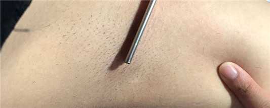 腋毛可以拔掉吗  腋毛 第1张