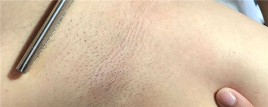 腋毛刮了还会长吗  腋毛 第1张