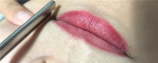 唇纹多怎么办 嘴唇 第2张 唇纹多怎么办 嘴唇 第2张