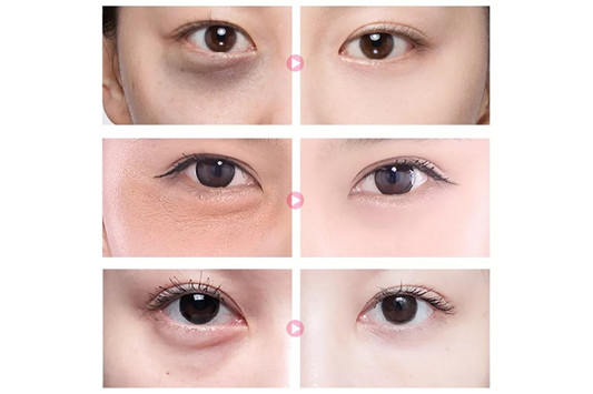 天气丹眼霜好用吗,天气丹眼霜怎么样 天气丹 眼霜 Whoo后 第6张 天气丹眼霜好用吗,天气丹眼霜怎么样 天气丹 眼霜 Whoo后 第6张