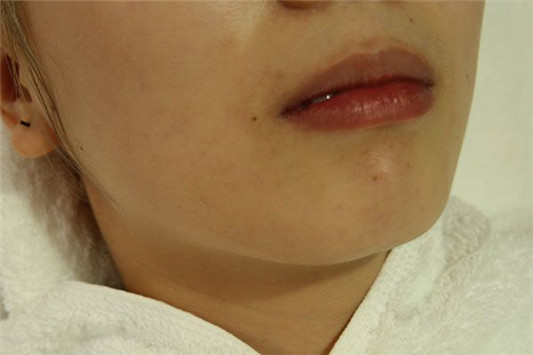 唇色深怎么涂口红，小妙招让你淡化唇纹