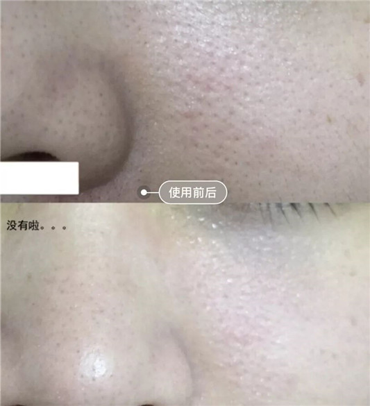 悦木之源泥娃娃面膜，还你一个娃娃脸  悦木之源 面膜 第11张