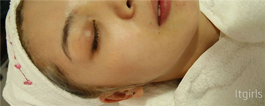 医美面膜可以随便用吗 面膜 第2张 医美面膜可以随便用吗 面膜 第2张