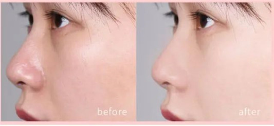 Nars蜜粉饼可以让你用到铁皮的定妆神器，绝对是粉饼中的战斗机  粉饼 Nars 定妆 第4张