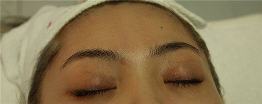 先眼霜还是面霜