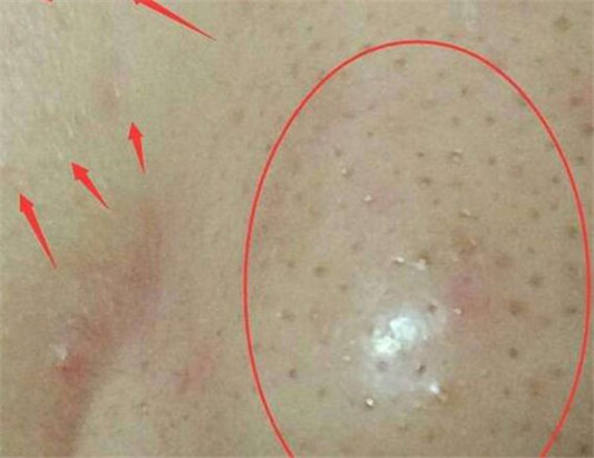 长期用粉底液危害皮肤吗，怎样避免伤害  粉底液 彩妆 第4张