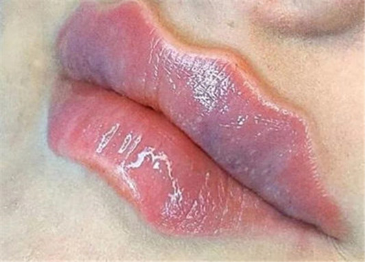 国外最近流行的大波浪魔鬼唇形怎么画