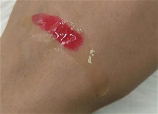 卸妆油怎么用才不会闷痘，卸妆油正确用法分析  卸妆油 彩妆 第2张