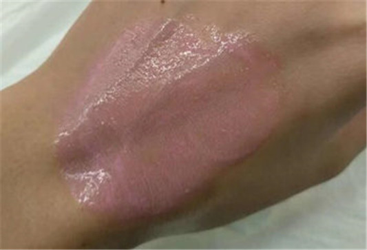 卸妆油怎么用才不会闷痘，卸妆油正确用法分析  卸妆油 彩妆 第4张