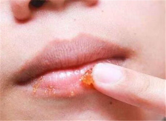 防晒润唇膏晚上可以涂吗,睡觉需要卸妆吗 防晒润唇膏 卸妆 彩妆 第2张 防晒润唇膏晚上可以涂吗,睡觉需要卸妆吗 防晒润唇膏 卸妆 彩妆 第2张