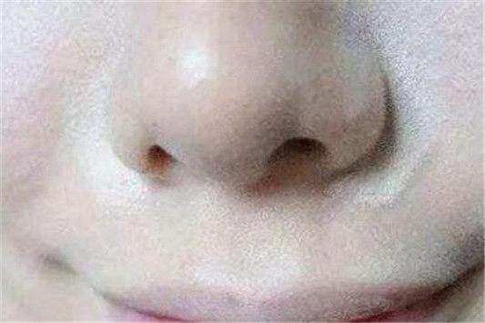 干皮适合气垫还是粉底液好用呢