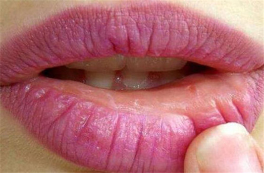 一涂口红就脱皮怎么办 几个小妙招解决 口红 脱皮 小妙招 彩妆 第2张 一涂口红就脱皮怎么办 几个小妙招解决 口红 脱皮 小妙招 彩妆 第2张