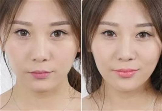 怎么化妆让嘴巴变小 教你自然缩小嘴巴真实有效  嘴巴 变小 方法 彩妆 第3张