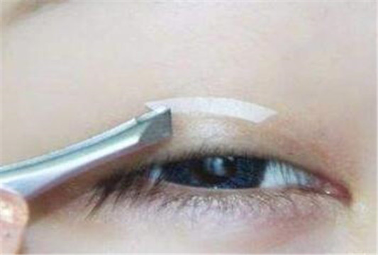 经常贴双眼皮贴的危害这么多 你还贴吗