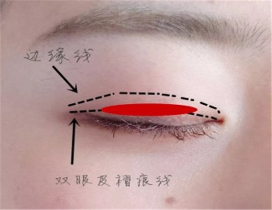 为什么双眼皮贴撑不起来 贴双眼皮贴详细教程  双眼皮 教程 彩妆 第2张