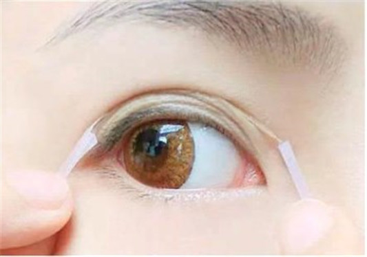 双眼皮贴老是翻出来怎么办 怎么贴好双眼皮贴  双眼皮 外翻 怎么办 彩妆 第3张