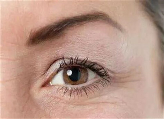 不能做双眼皮的眼睛图都有哪些 双眼皮 眼睛 彩妆 第4张 不能做双眼皮的眼睛图都有哪些 双眼皮 眼睛 彩妆 第4张