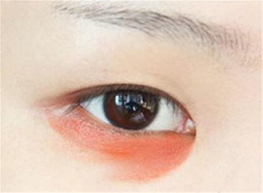 怎样用口红遮盖黑眼圈,有什么危害吗  黑眼圈 口红 彩妆 第2张