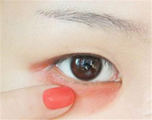 怎样用口红遮盖黑眼圈,有什么危害吗  黑眼圈 口红 彩妆 第3张