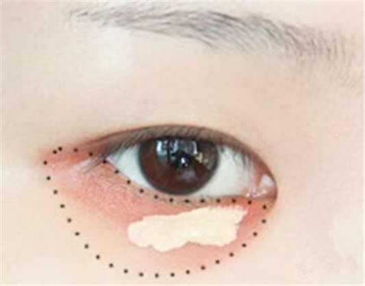 怎样用口红遮盖黑眼圈,有什么危害吗  黑眼圈 口红 彩妆 第4张