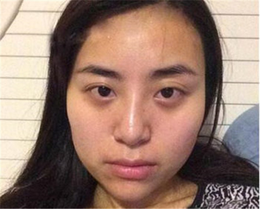 黑眼圈用什么颜色遮瑕膏 遮瑕的方法是什么  遮瑕膏 黑眼圈 方法 彩妆 第2张