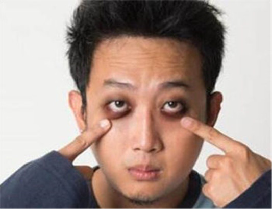 黑眼圈用什么颜色遮瑕膏 遮瑕的方法是什么  遮瑕膏 黑眼圈 方法 彩妆 第4张