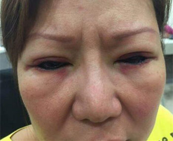 纹眼线对眼睛有害吗，6大危害分析  纹眼线 彩妆 第4张