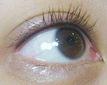 纹眼线对眼睛有害吗，6大危害分析  纹眼线 彩妆 第5张