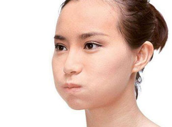 最好用的去法令纹偏方哪些安全有效  法令纹 偏方 抗皱护肤 第5张