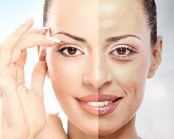 什么方法可以去除脸上的皱纹