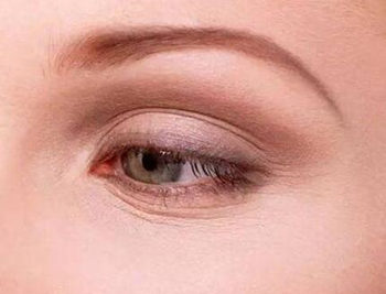 下眼睑皱纹严重怎么办，五种方法推荐