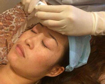 多少岁开始抗衰老  抗衰老 抗皱护肤 第5张