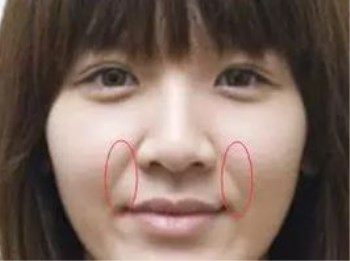 法令纹是如何形成的，成因及预防  法令 抗皱护肤 第2张