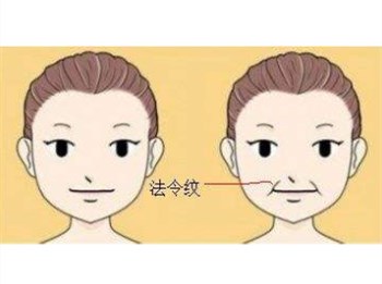 法令纹是如何形成的，成因及预防  法令 抗皱护肤 第4张