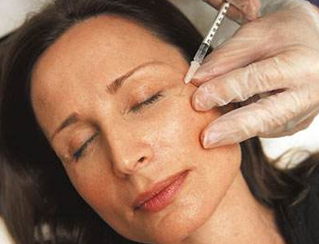 除皱针多久表情不僵硬