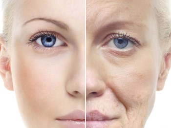 鼻翼两侧法令纹怎么消除，原因及方法