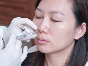 鼻翼两侧法令纹怎么消除，原因及方法  鼻翼 法令 抗皱护肤 第3张