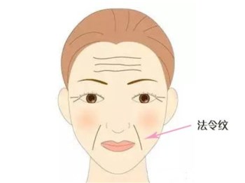 鼻翼两侧法令纹怎么消除，原因及方法  鼻翼 法令 抗皱护肤 第5张