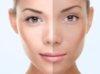 皮肤松弛暗黄怎么办什么原因  皮肤 怎么办 美白祛黄 第4张