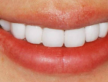 嘴巴周围皮肤发黄怎么回事